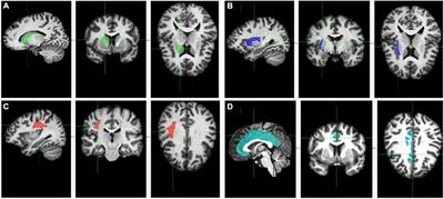 White matter integrity as a mediator between socioeconomic status and executive function